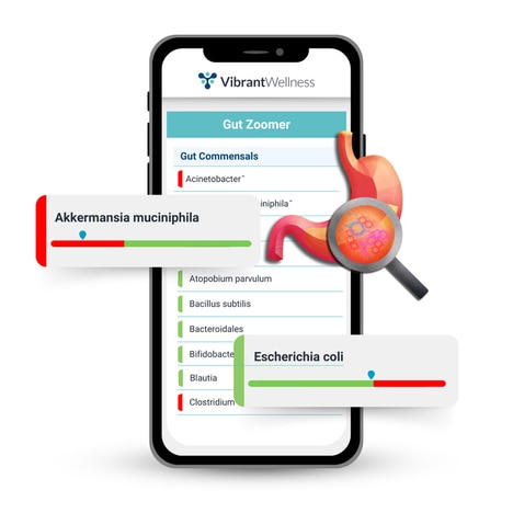 Revamped Gut Microbiome Tests