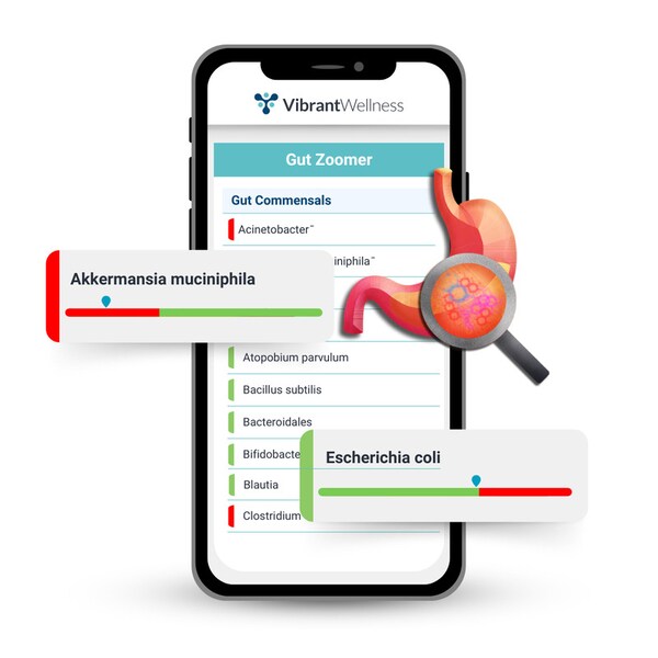 Revamped Gut Microbiome Tests