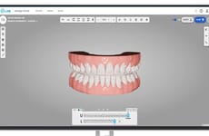 Uphraded Orthodontic Technology Platforms