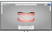 Uphraded Orthodontic Technology Platforms