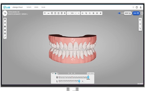 Uphraded Orthodontic Technology Platforms