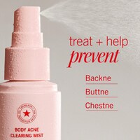 All-Over Acne Sprays