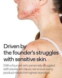 Science-Driven Dermatitis Creams Image 2
