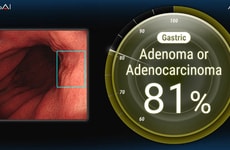 Endoscopic AI Innovations