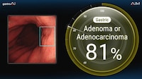 Endoscopic AI Innovations Image 1