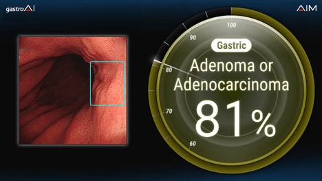 Endoscopic AI Innovations