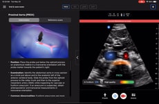 AI-Enhanced Ultrasound Technologies