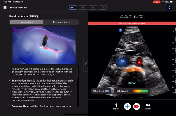 AI-Enhanced Ultrasound Technologies