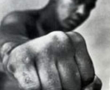 24 Pugilistic Features