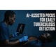 AI Tuberculosis Detection Tools Image 1