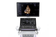 AI-Powered Cardiovascular Ultrasound Systems
