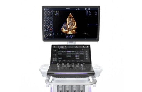 AI-Powered Cardiovascular Ultrasound Systems