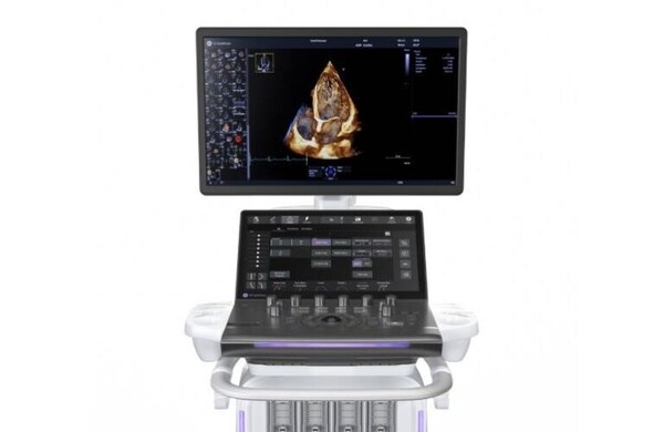 AI-Powered Cardiovascular Ultrasound Systems