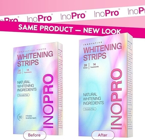 At-Home Teeth Whitening Kits
