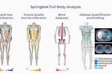 Rapid MRI Scan Services