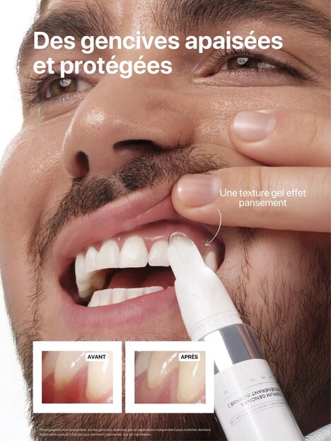 Regenerating Gum Serums
