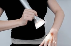 Ai Burn Treatment Concepts