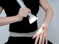 Ai Burn Treatment Concepts Image 1