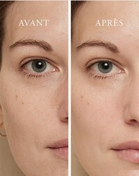 Rapid-Treatment Targeted Skincare Products Image 4