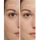 Rapid-Treatment Targeted Skincare Products Image 4