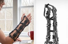 Adjustable Fracture Braces