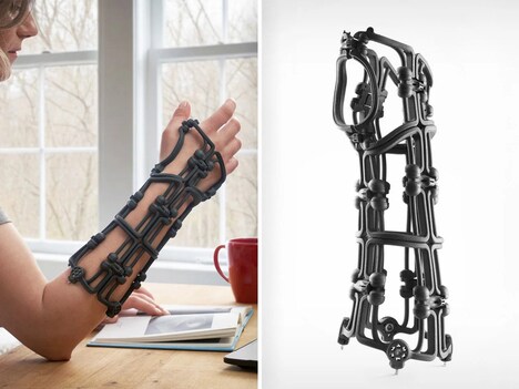 Adjustable Fracture Braces