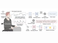 Speech Rehabilitation Aid Chokers Image 3