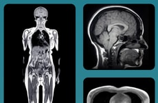 Preventive Full-Body Scans