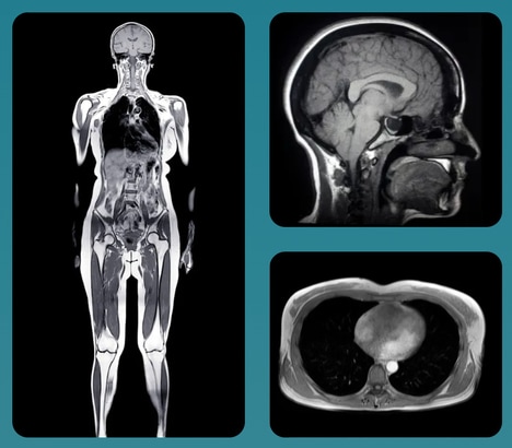 Preventive Full-Body Scans