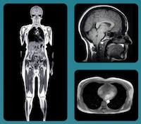 Preventive Full-Body Scans Image 1