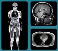 Preventive Full-Body Scans