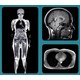 Preventive Full-Body Scans Image 1