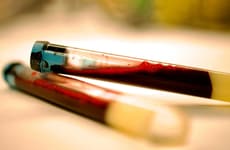 Early Parkinson&rsquo;s Blood Biomarkers