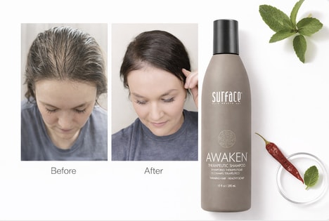 Growth-Encouraging Therapeutic Shampoos