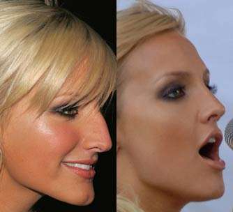 5 Minute Nose Jobs