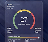 Gut-Brain Wellness Tests Image 2