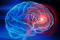 Injectable Nanomaterial Therapies
