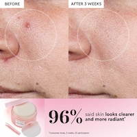 Gently Exfoliating Toner Pads Image 3