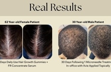 Stress-Adaptive Hair Therapy Systems