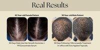 Stress-Adaptive Hair Therapy Systems Image 1