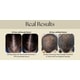 Stress-Adaptive Hair Therapy Systems Image 1