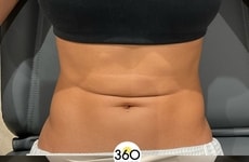 Next-Generation Skin Firming Protocols