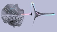 Multi-Model Answer Platforms Image 1