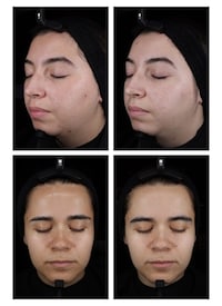 Oily Skin-Friendly Sunscreen Lines Image 2