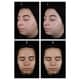 Oily Skin-Friendly Sunscreen Lines Image 2