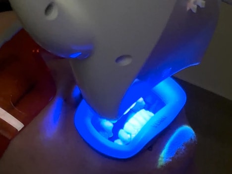 Blue Light Toothbrushes