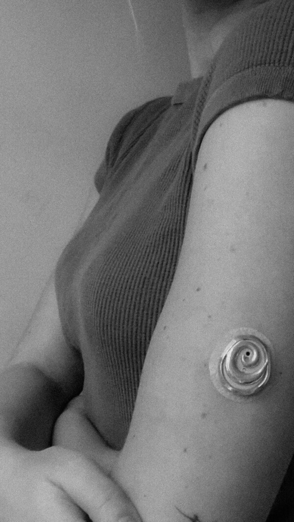 Diabetic Jewelry Designs: Isletta Creates Sensor Shells to Beautify ...