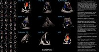 Video-Based Cardiac AI Tools Image 1