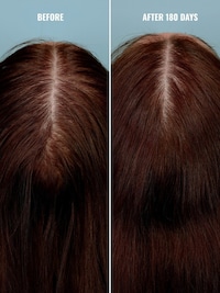 Hair Growth-Focused Dietary Supplements Image 2