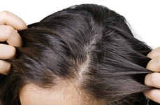Biotech Scalp Care Solutions